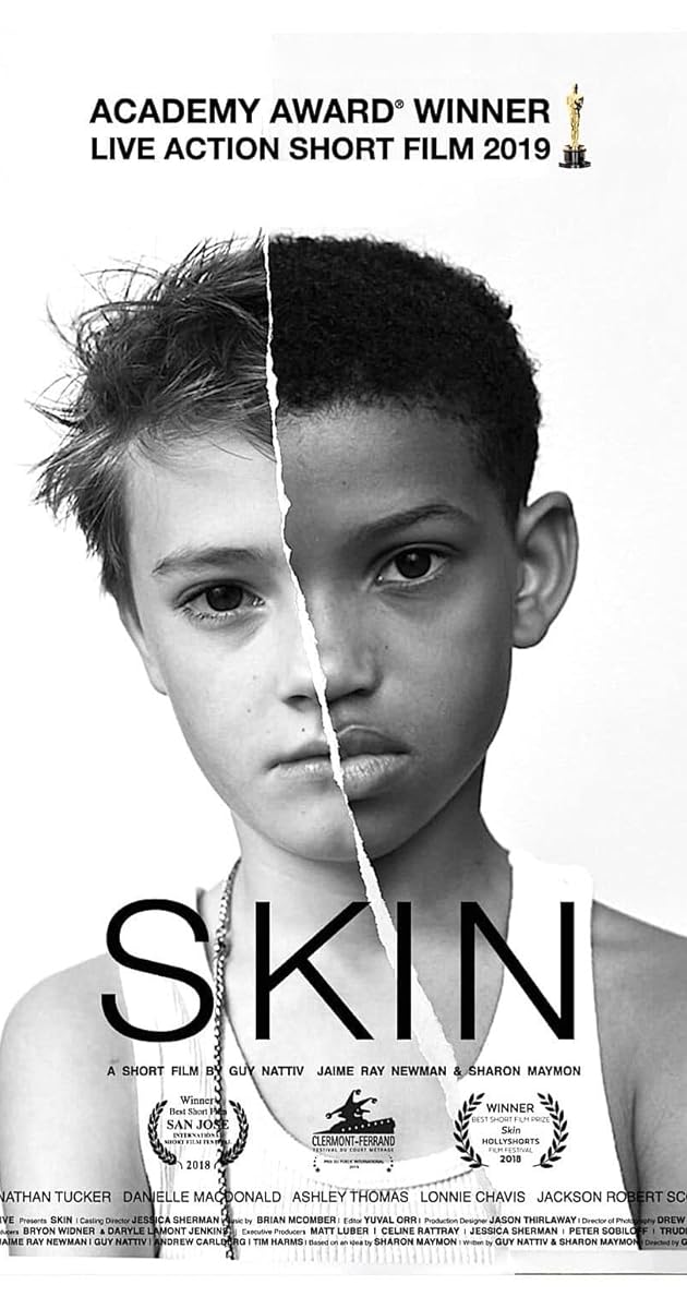 Skin