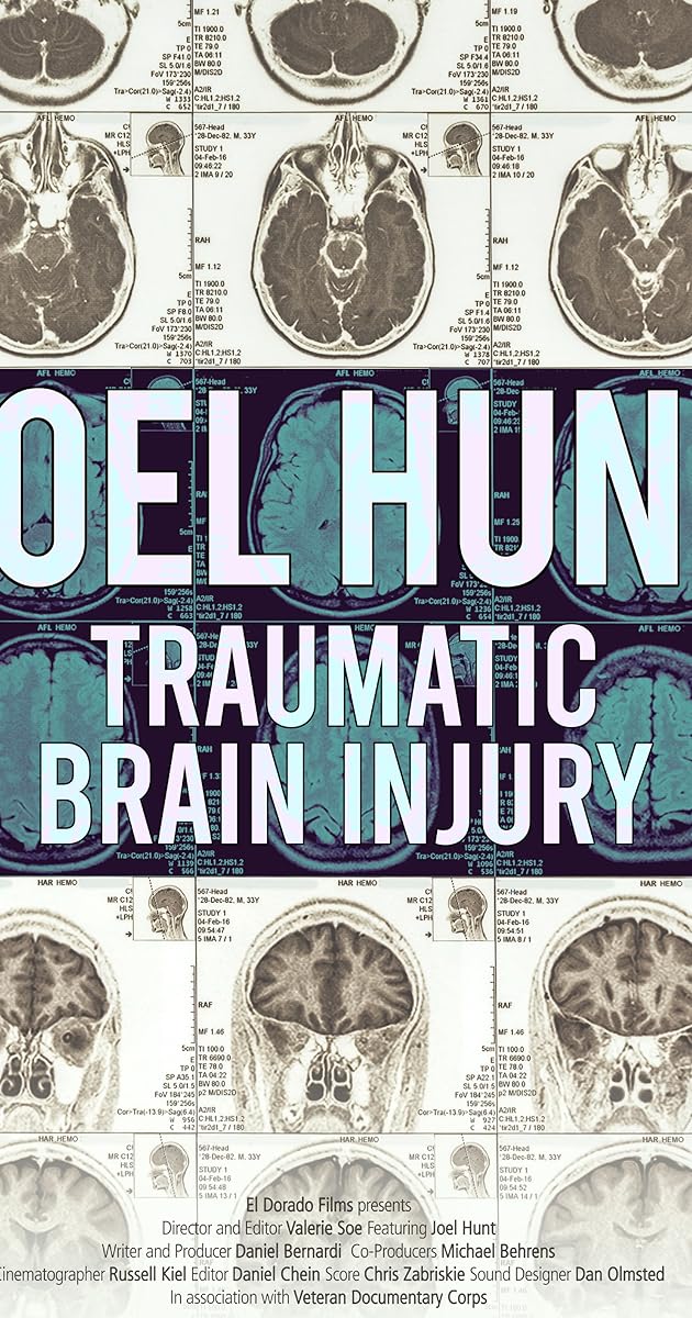 Joel Hunt: Traumatic Brain Injury (TBI)