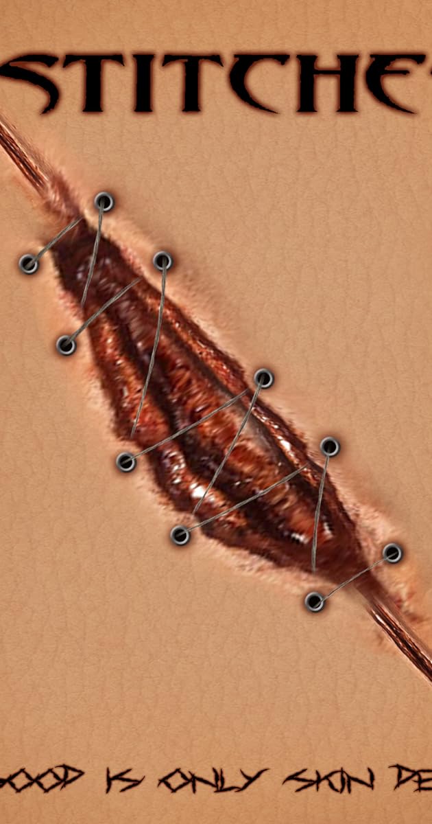 Stitches