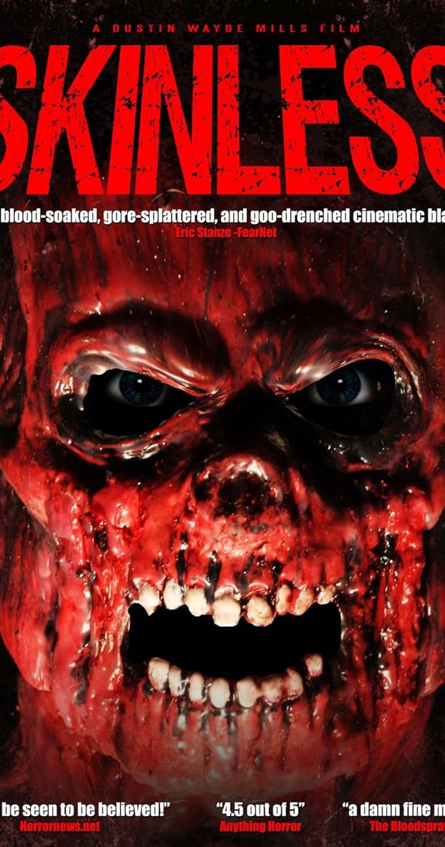 The Ballad of Skinless Pete