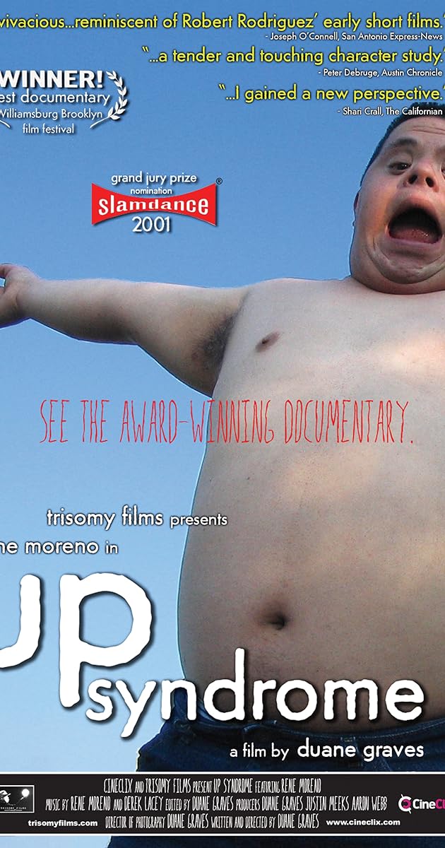 Up Syndrome