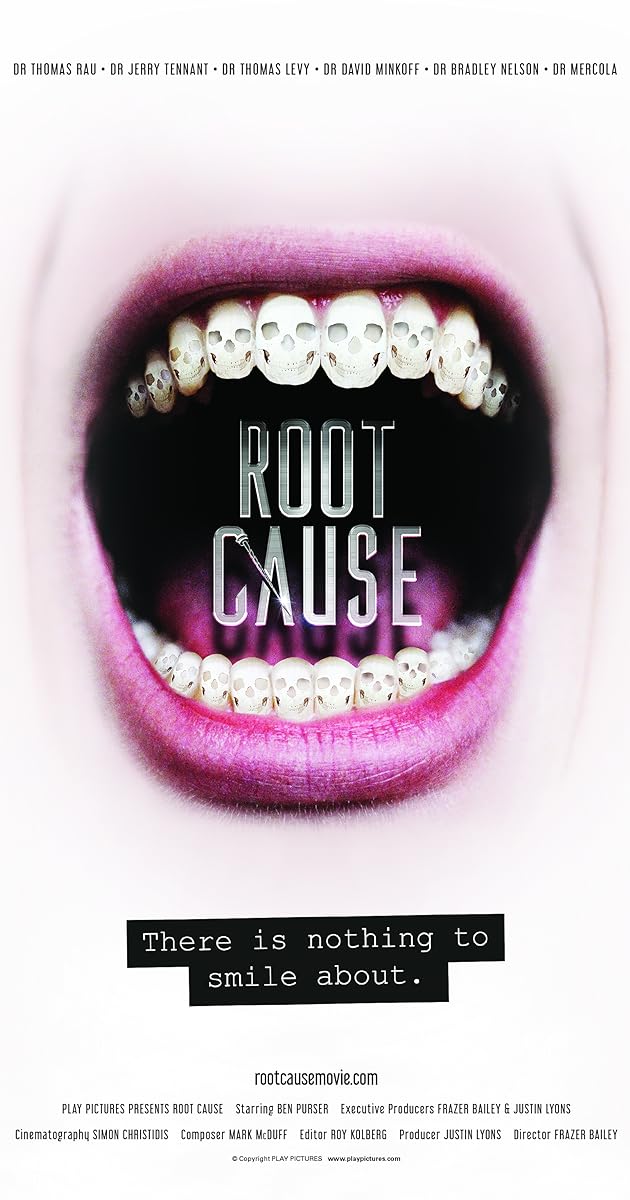 Root Cause